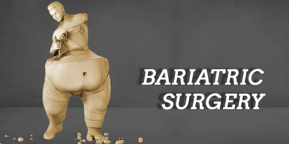 Best Bariatric surgeon in bangalore