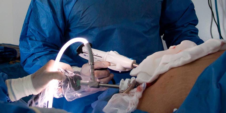Best Appendix Surgery in Bangalore