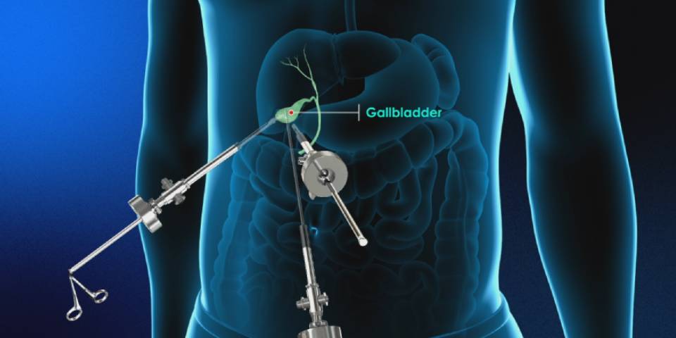 Best Gall bladder Surgeon in Bangalore