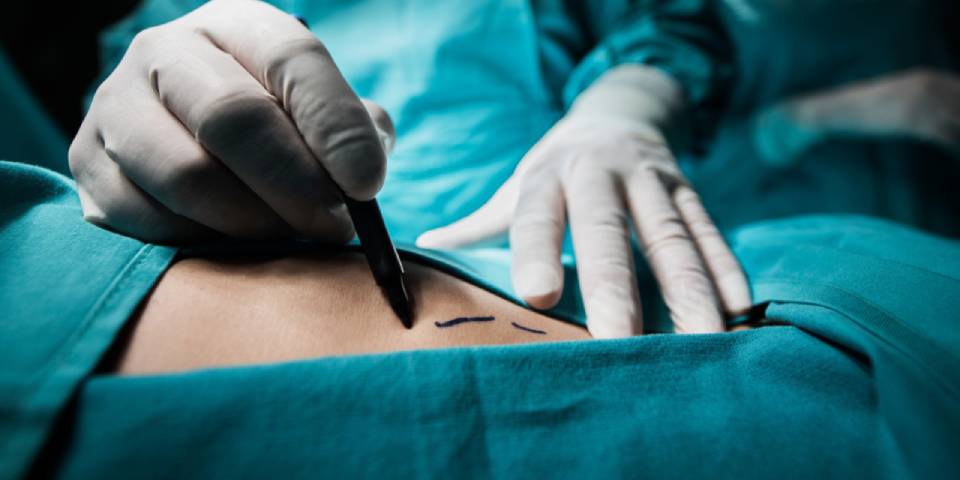 Weight loss Surgery