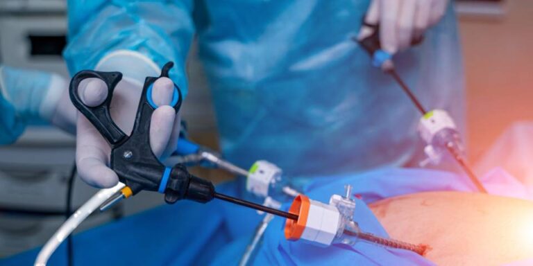 Laparoscopic Surgery