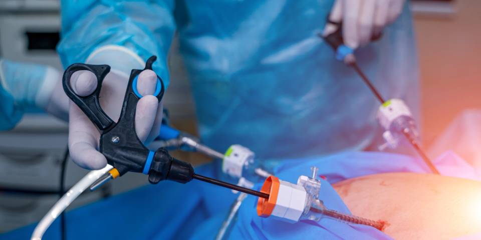 Laparoscopic Surgery