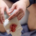 Blood in Stool: What It Means and What to Do About It