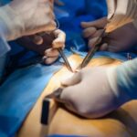 Impact of Gallbladder Removal on Life | Gallbladder Surgery - Dr Bhushan Chittawadagi