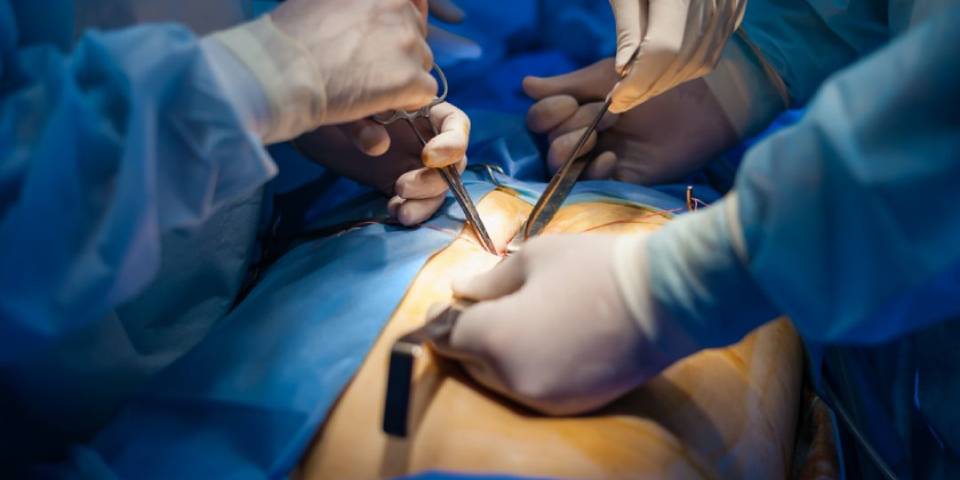Impact of Gallbladder Removal on Life | Gallbladder Surgery - Dr Bhushan Chittawadagi