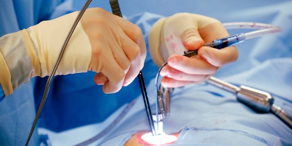 Laser Treatment_ A Best way to treat problem of Piles