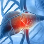 Best Fatty Liver Treatment in Bangalore by Dr. Bhushan Chittawadagi