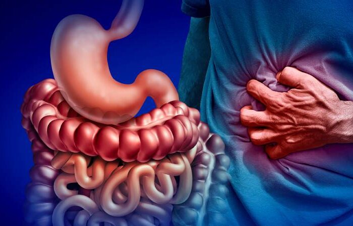 Inflammatory Bowel Disease (IBD) Treatment in Bangalore by Dr. Bhushan Chittawadagi