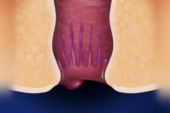 Young adult consulting Dr. Bhushan Chittawadagi for piles treatment in Bangalore