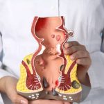 Young adult suffering from piles due to sedentary lifestyle and constipation