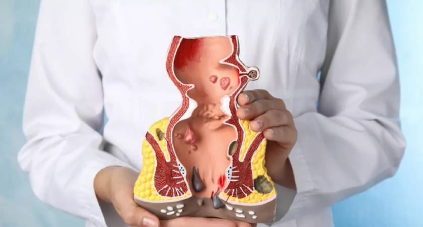 Young adult suffering from piles due to sedentary lifestyle and constipation