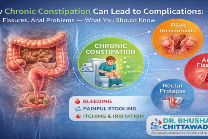 Chronic constipation complications treated by Dr. Bhushan Chittawadagi in Bangalore